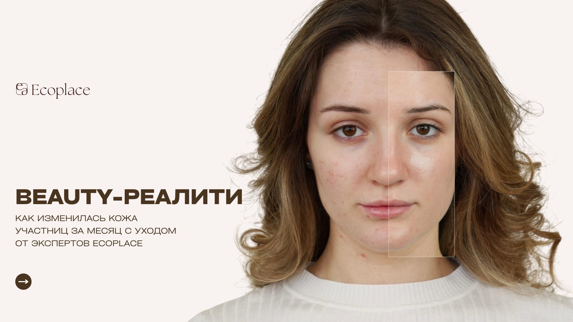 Баннер Экоплейс