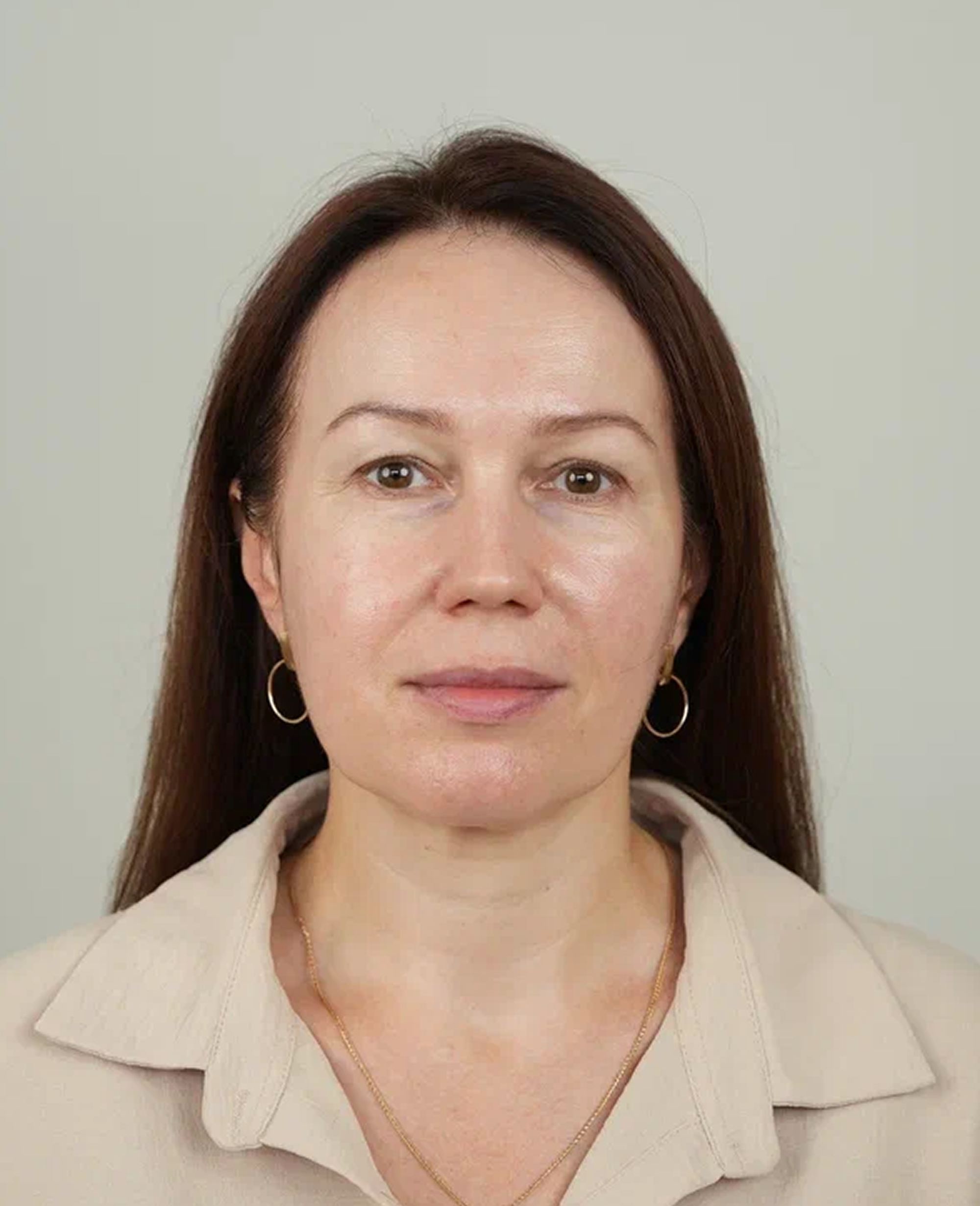 После
