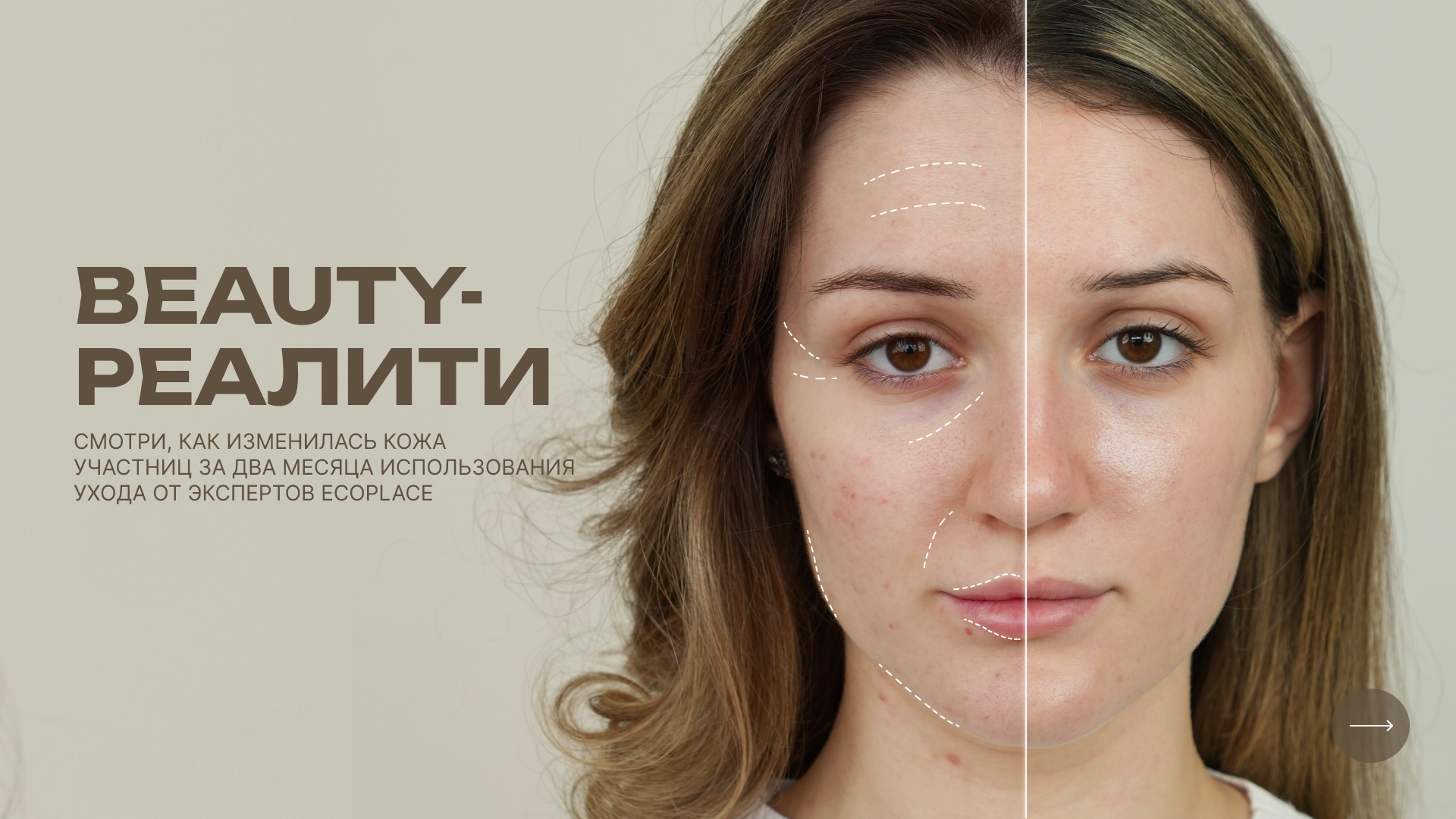 Баннер Экоплейс
