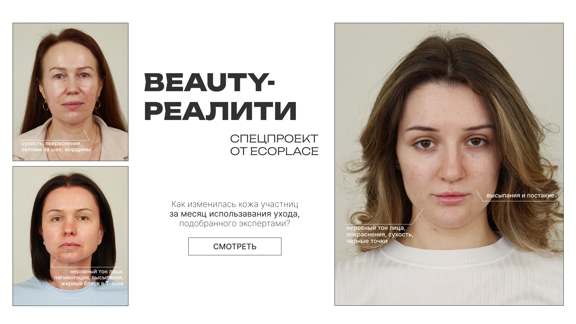 Баннер Экоплейс
