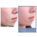 Гальванический массажер для&nbsp;лица PEARLCARE New&nbsp;Sonic Galvanic Massager (180*55*60/127г) | Ecoplace