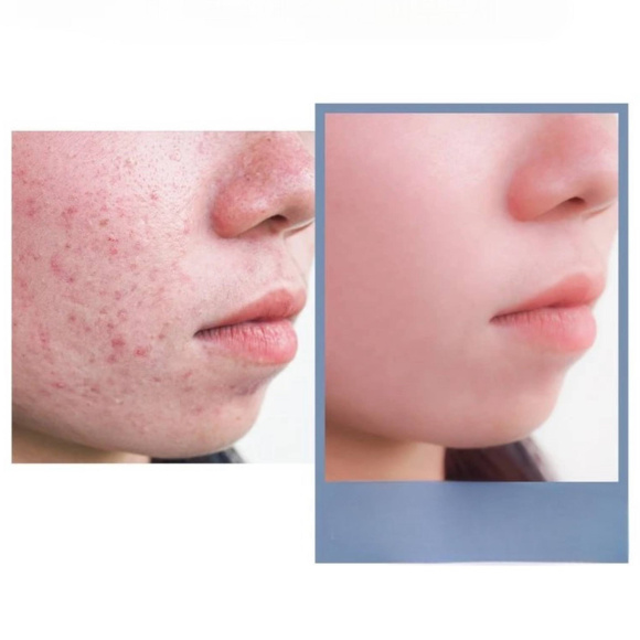 PEARLCARE New&nbsp;Sonic Galvanic Massager (180*55*60/127g) | Ecoplace