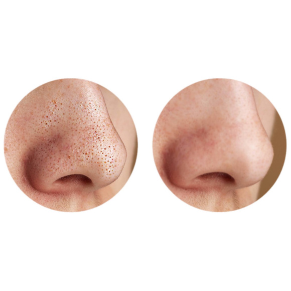 PEARLCARE Pore Vacuum Cleaner (60*65*110/125g) | Ecoplace